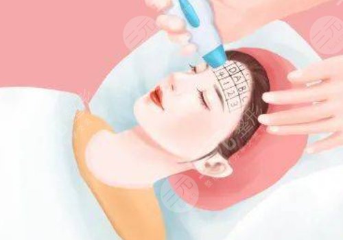 激光提拉紧致脸多少钱?