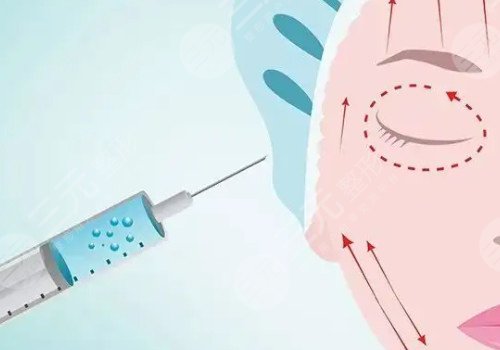 玻尿酸填充位置移动怎么办？