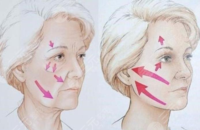 上海林晓曦拉皮拉皮案例