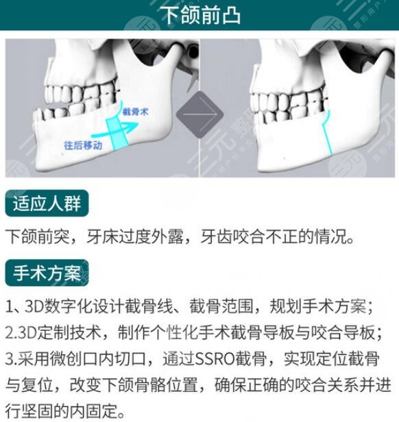 鞋拔子脸