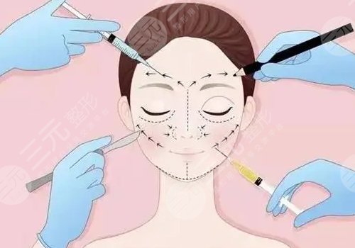 填泪沟用胶原蛋白多少钱?