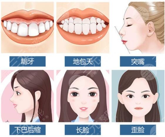 嘴凸法令纹重可以整形吗?3种改良方案分享,医美不盲目!