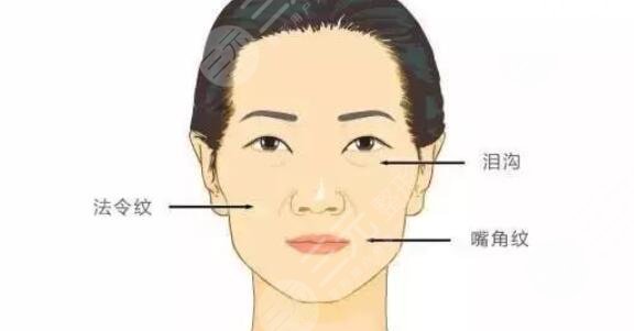 内轮廓固定外轮廓固定