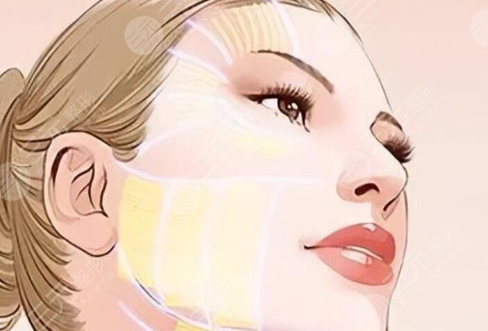 内轮廓固定外轮廓固定