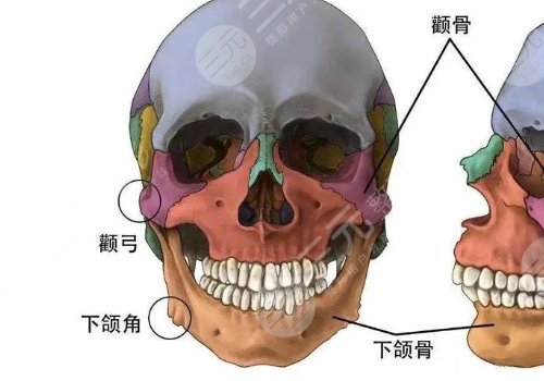 脸部骨骼变形能矫正吗?