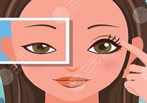 做眼部提拉手术能维持多久?