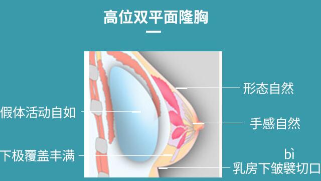 下皱襞隆胸多久恢复正常,要注意什么?术前必备科普指南!
