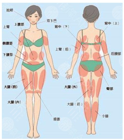 吸脂肚子10斤多少费用?
