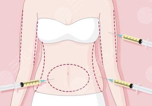 潘红伟医生有名吗？