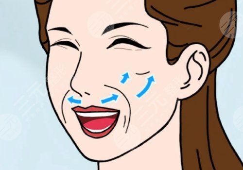 脸部提拉紧致手术多少钱？手术方式有哪些？多久能恢复？