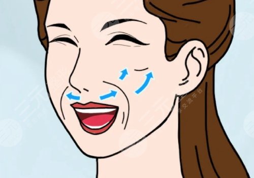 小拉皮手术好处和坏处有哪些?