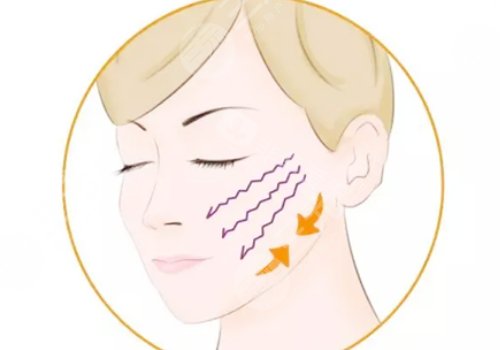 小拉皮手术好处和坏处有哪些?