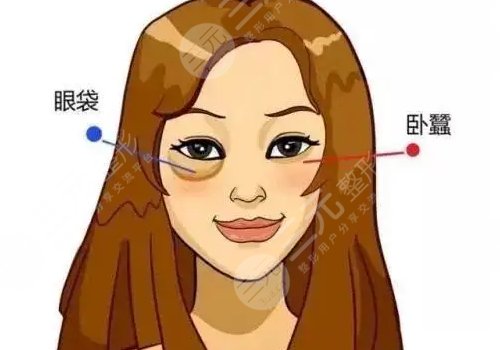 做眼袋一般需要多少钱？