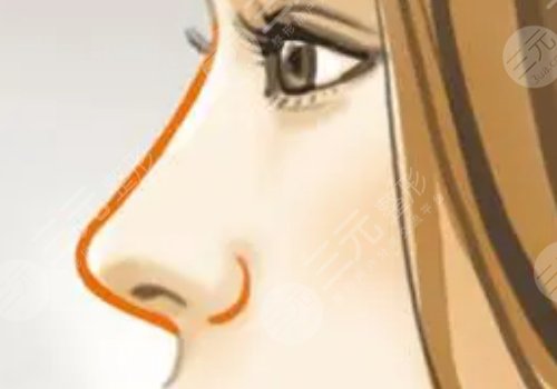 黄开亮做鼻子做的好吗？