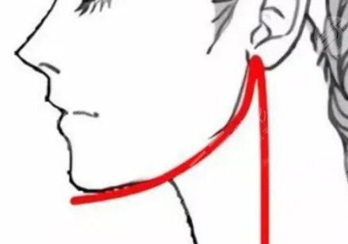 姜宇禄磨骨案例