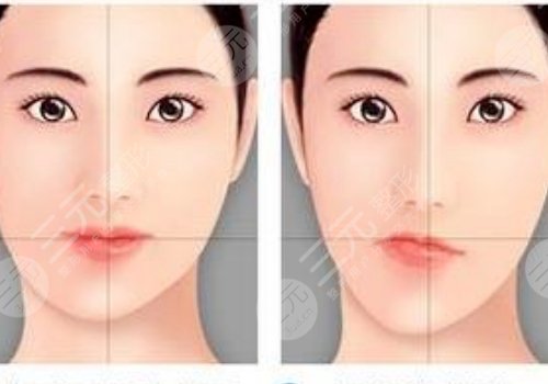 嘴巴歪整形大概多少钱?