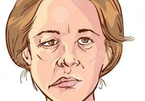 嘴巴歪整形大概多少钱?