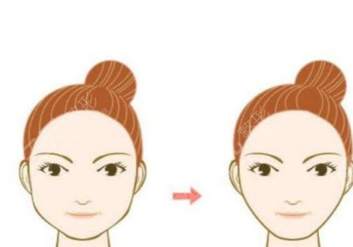 脸部轮廓固定要多少钱一次呢?气质脸型get攻略!