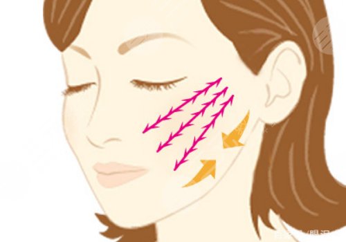 筋膜悬吊面部提升和线雕哪个好？