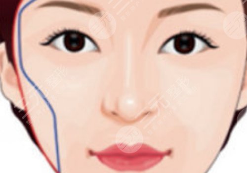 面部轮廓固定怎么做？