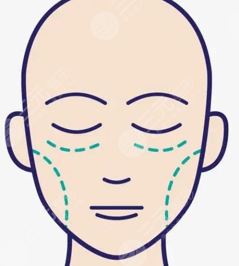 丁昆琨苹果肌复位案例