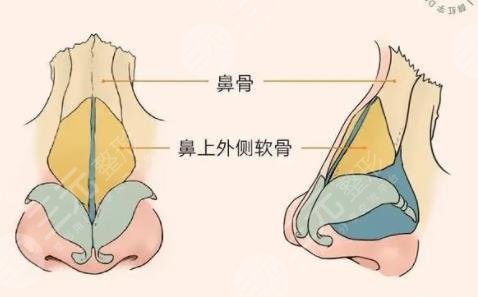 鼻修复