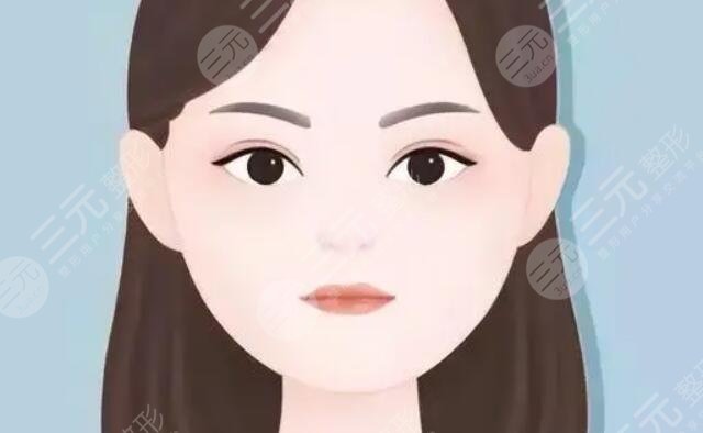 面部吸脂