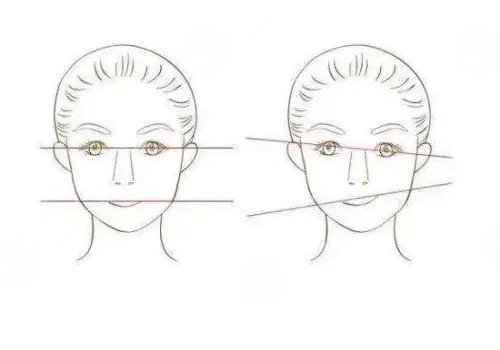 脸歪大小脸怎么矫正?