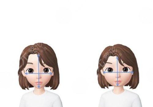 脸歪大小脸怎么矫正?