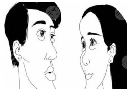 月亮脸矫正手术多少钱？