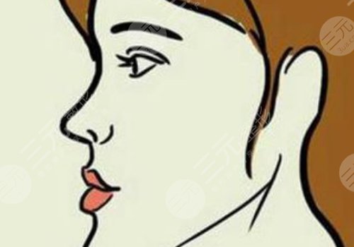 月亮脸矫正手术多少钱？