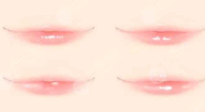 下嘴唇很不对称