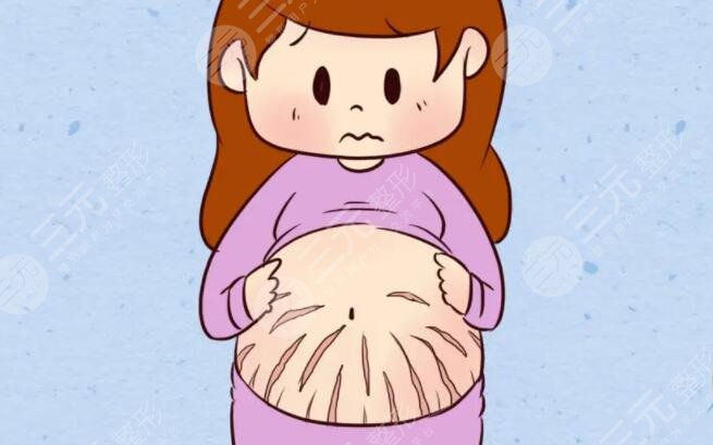 去妊娠纹