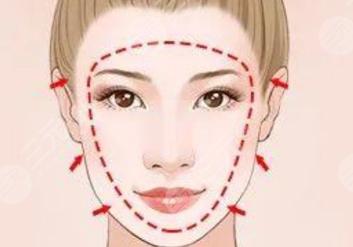 外轮廓包括哪些部位？