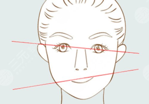 内轮廓和外轮廓的位置区别