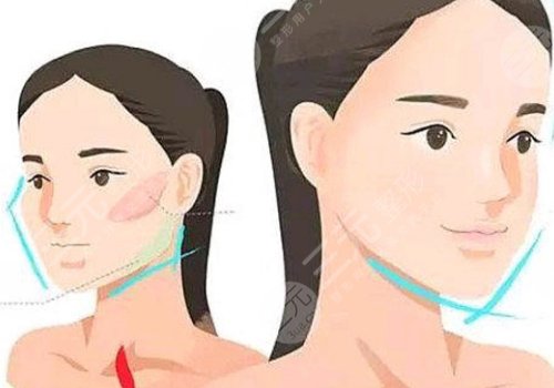 内轮廓和外轮廓的位置图片