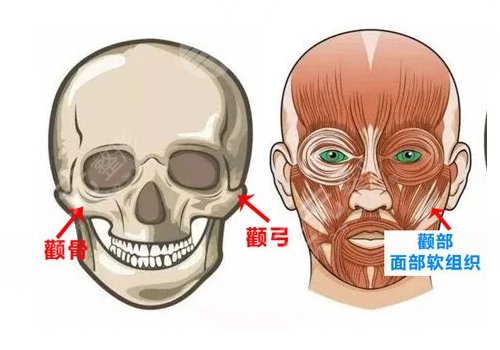 磨颧骨手术一般要多少钱？
