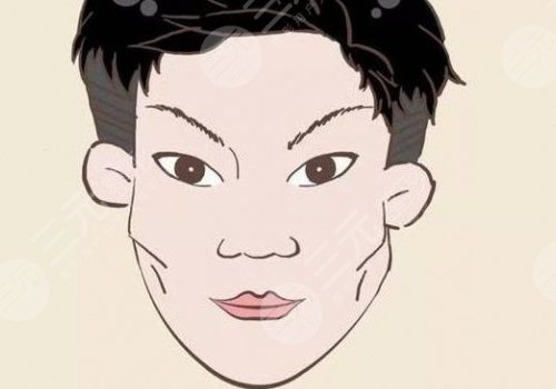 磨颧骨手术一般要多少钱？