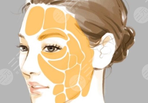 凹陷修复多少钱一个坑？