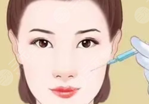 紧致提升针能保持多久？