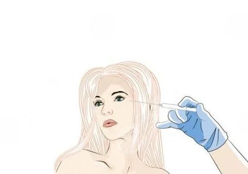 紧致提升针能保持多久？