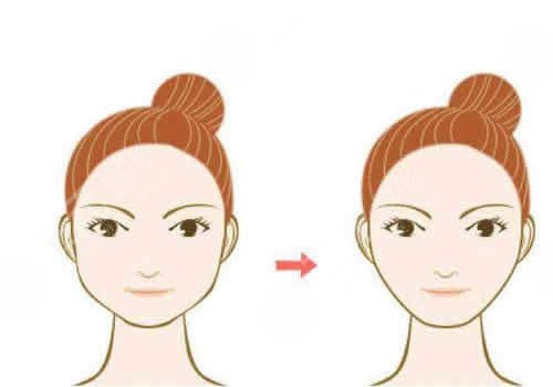做完轮廓手术脸更大了怎么回事？