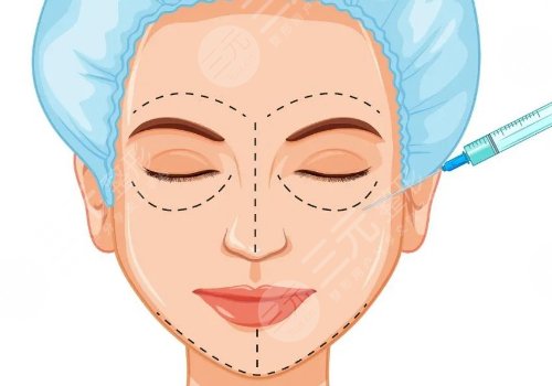 做完轮廓手术脸更大了怎么回事？