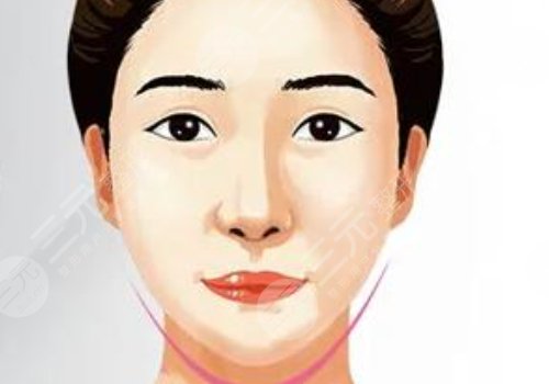 内外轮廓固定做手术要多久？