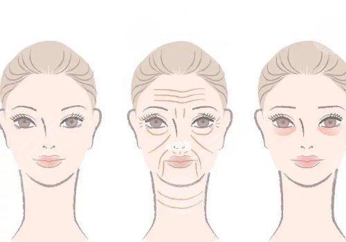 50岁做面部提升多少钱?