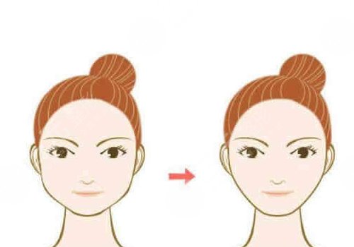 磨骨从哪里开刀？