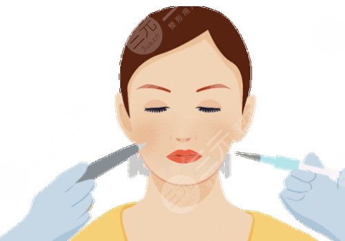 打了轮廓针多久可以怀孕