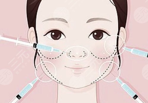 打了轮廓针多久可以怀孕