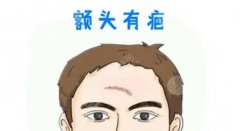 整形去除脸部缝针疤痕的方法科普！祛疤修复价格表分享！