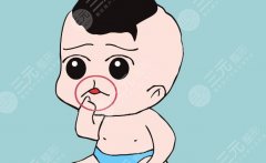 唇腭裂什么时候做整形？畸形修复必看指南！